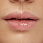 حجم دهنده لب کیکو - Image 2