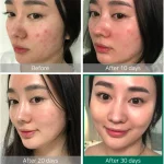 اسنس ترمیم کننده و جوانساز حلزون کوزارکس اصل - Image 3